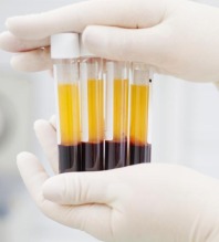 PRP
